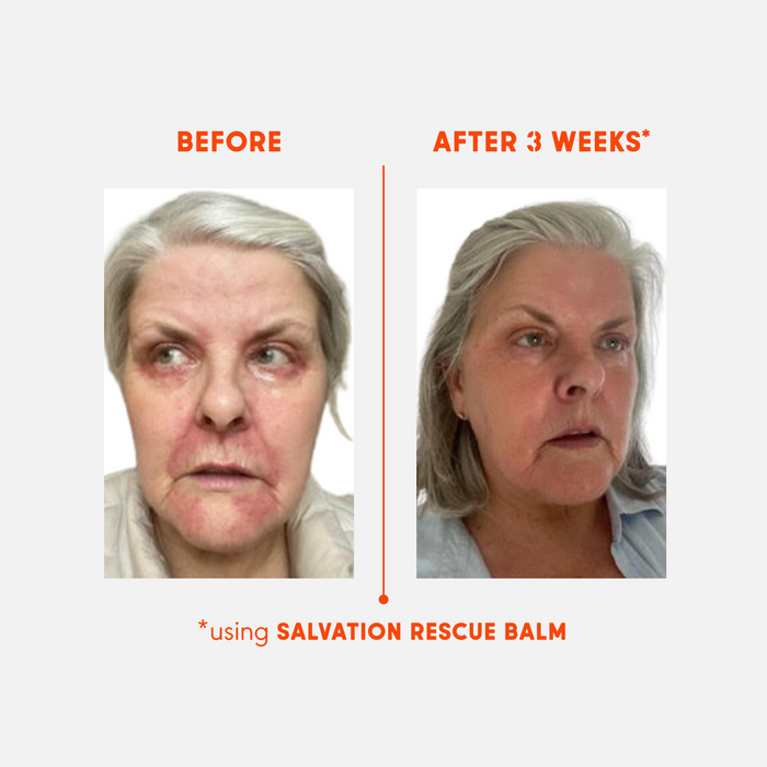 SALVATION. Rescue Balm